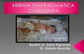 Bea hernia diafragmatica congenita