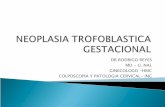 3.Enfermedad Trofoblastica Gestacional