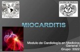 Miocarditis 3322