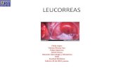Leucorrea sexposición hidcdefinitiva1