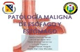 Patologia maligna esofago 2003