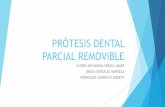 Prótesis dental parcial removible.