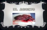 El aborto[1]