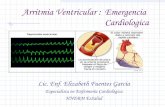 Arritmia ventricular