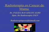 RADIOTERAPIA Breast  cancer Paliza