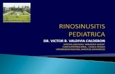 Sinusitis crónica en niños