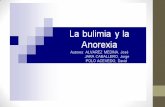 Firme diapositivas bulimia y anorexia