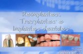 Reimplantes, trasplantes e implantes dentales
