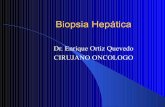 Biopsia hepática