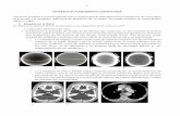 Artefactos en CT, ecografía, MRI y radiologia digital