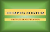 Herpes zoster vacuna