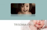 Trisomia xxi