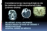 Consideraciones neuroquirúrgicas en lesiones multicompartamentales órbito-craneales. ARTURO AYALA ARCIPRESTE MD FAANS