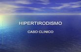 Caso clinico hipertiroidismo