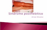 Sindrome Postflebitico Y Tecnicas Qx