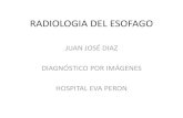 Radiologia del esofago