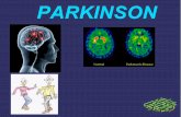 Sistema Nervioso PARKISON