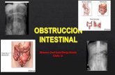 Obstruccion intestinal