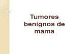 Tumores benignos de la mama