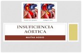 Insufuciencia Aortica - Dr. Bosio