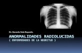Enfermedades de la negritud (lesiones radiolucidas)