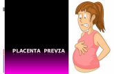 Placenta previa u.u