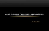 Manejo radiologico de la hemoptisis