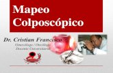 Mapeo colposcópico, su Importancia Diagnóstica.