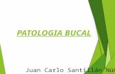 Patologia bucal - Juan Carlo Santillan Nuñez