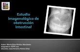 Estudio imagenológico de obstrucción intestinal