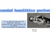 Enfermedad hemolítica perinatal
