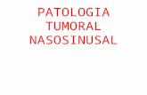 Patologia tumoral nasosinusal
