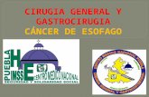 Cancer de esofago