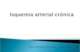 Isquemia arterial crónica