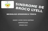 Sindrome de Brock-Lyell
