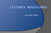 Lesiones musculares