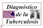 Presentación1 tuberculosis para area 6