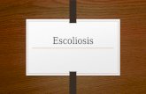 Escoliosis y spondylitis anquilosante
