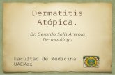 Dermatitis atópica. Dermatología.