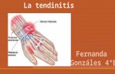la tendinitis