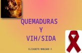 QUEMADURAS Y VIH SIDA