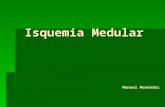 Isquemia medular