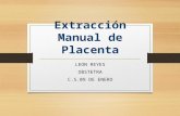 Extracción manual de placenta