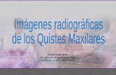 Imagenes radiograficas de los Quistes Maxilares