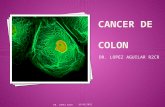 Cancer de  colón