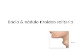Bocio & nódulo tiroideo solitario