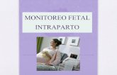 Monitoreo Electrónico Fetal Intraparto