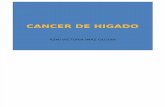 Cancer de Higado