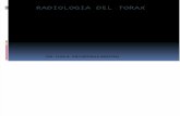 SEMIOLOGIA RADIOLOGICA DEL TORAX.pdf