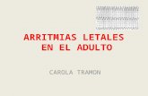 CLASE 19 Arritmias Letales